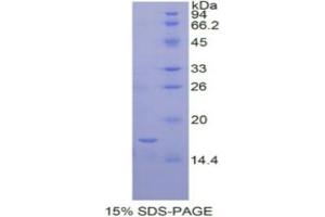 SDS-PAGE analysis of Human IL12Rb2 Protein. (IL12RB2 蛋白)