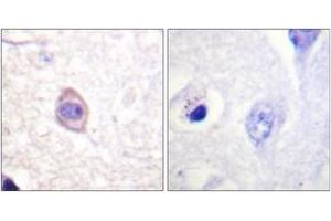 Immunohistochemistry analysis of paraffin-embedded human brain, using Interferon-gamma Receptor alpha (Phospho-Tyr457) Antibody. (IFNGR1 抗体  (pTyr457))