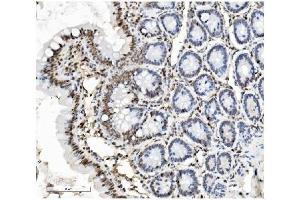 IHC analysis of PTBP1 using anti-PTBP1 antibody (ABIN7599450).