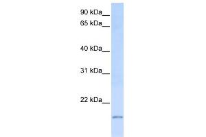 WB Suggested Anti-C20orf30 Antibody Titration:  0. (C20orf30 抗体  (C-Term))