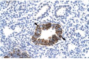 Rabbit Anti-MXI1 Antibody Catalog Number: ARP31403 Paraffin Embedded Tissue: Human Lung Cellular Data: Epithelial cells of bronchiole Antibody Concentration: 4. (MXI1 抗体  (Middle Region))