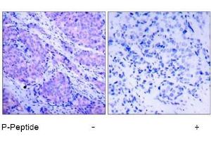 Image no. 1 for anti-3-phosphoinositide Dependent Protein Kinase-1 (PDPK1) (pSer241) antibody (ABIN196617) (PDPK1 抗体  (pSer241))
