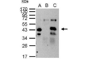 IP Image XPA antibody immunoprecipitates XPA protein in IP experiments.