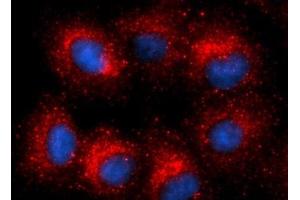 Immunofluorescence (IF) image for anti-Cytochrome B5 Reductase 3 (CYB5R3) (AA 27-301) antibody (PE) (ABIN5565252)