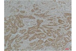 Immunohistochemical (IHC) analysis of paraffin-embedded Mouse Brain Tissue using a-tubulin(Acetyl Lys40) Mouse Monoclonal Antibody diluted at 1:200. (alpha Tubulin 抗体  (acLys40))
