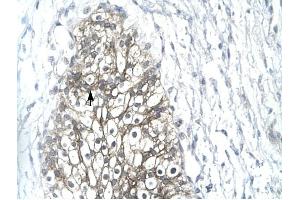 MMP19 antibody was used for immunohistochemistry at a concentration of 4-8 ug/ml to stain Epithelial cells (arrows) in Human Urinary bladder. (MMP19 抗体  (C-Term))
