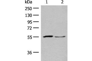 Western blot analysis of Human placenta tissue and PC3 cell lysates using SLC2A8 Polyclonal Antibody at dilution of 1:400 (SLC2A8 抗体)