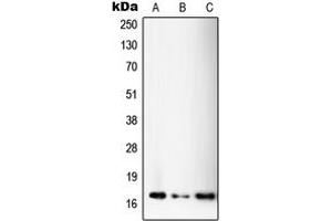Western blot analysis of SSBP1 expression in A375 (A), HeLa (B), MOLT4 (C) whole cell lysates. (SSBP1 抗体  (C-Term))