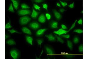 Immunofluorescence of monoclonal antibody to KRT20 on HeLa cell. (KRT20 抗体  (AA 1-424))