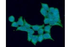 ICC/IF analysis of ALDH5A1 in 293T cells line, stained with DAPI (Blue) for nucleus staining and monoclonal anti-human ALDH5A1 antibody (1:100) with goat anti-mouse IgG-Alexa fluor 488 conjugate (Green). (ALDH5A1 抗体)