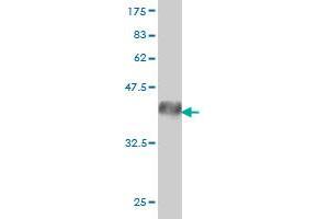 Western Blot detection against Immunogen (39. (EPH Receptor A3 抗体  (AA 202-326))