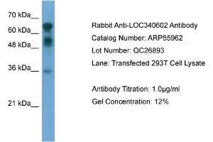 WB Suggested Anti-CXorf67  Antibody Titration: 0. (CXorf67 抗体  (Middle Region))