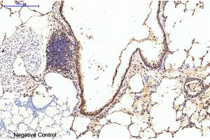 Immunohistochemical analysis of paraffin-embedded rat lung tissue. (EIF4A1 抗体)