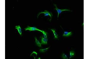 Immunofluorescence staining of U251 cells with ABIN7147776 at 1:133, counter-stained with DAPI. (CNTF 抗体  (AA 4-196))
