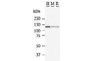 Image no. 1 for anti-Matrin 3 (MATR3) antibody (ABIN328222) (MATR3 抗体)