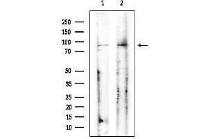 anti-Cation Channel, Sperm-Associated, beta (CATSPERB) (C-Term) antibody