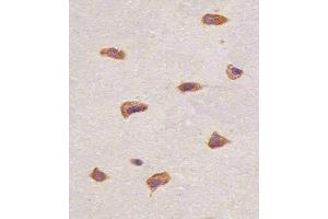 Paraformaldehyde-fixed, paraffin embedded human brain tissue, Antigen retrieval by boiling in sodium citrate buffer (pH6. (FGFR1 抗体)