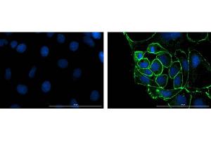 Immunofluorescence microscopy of ZO-1 Immunofluorescence microscopy of Anti-ZO-1 in Caco-2 cells using FITC-conjugated Fluorescent anti-rabbit IgG  for detection. (TJP1 抗体)