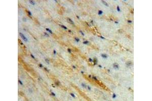 Used in DAB staining on fromalin fixed paraffin-embedded Heart tissue (Corin 抗体  (AA 334-477))