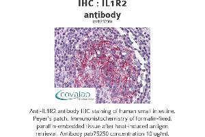 Image no. 1 for anti-Interleukin 1 Receptor, Type II (IL1R2) antibody (ABIN1735893)