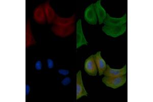 ABIN6258515 and ABIN6274734 staining Hela cells by IF/ICC. (MRPL20 抗体  (C-Term))