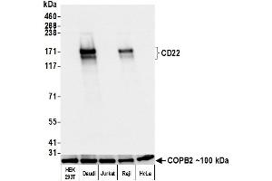 Western Blotting (WB) image for anti-CD22 Molecule (CD22) (AA 20-687) antibody (ABIN7453999) (Recombinant CD22 抗体  (AA 20-687))