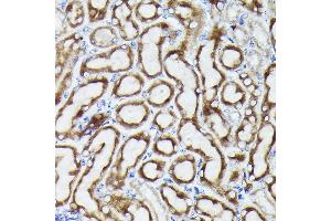 Immunohistochemistry (IHC) image for anti-Voltage-Dependent Anion Channel 3 (VDAC3) (AA 1-283) antibody (ABIN6150077)
