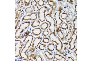 Immunohistochemistry of paraffin-embedded mouse kidney using VD Rabbit pAb (ABIN6130775, ABIN6150077, ABIN6150078 and ABIN6214830) at dilution of 1:25 (40x lens). (VDAC3 抗体  (AA 1-283))