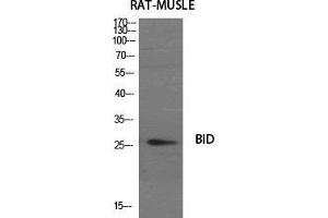 Western Blot (WB) analysis of specific cells using BID Polyclonal Antibody. (BID 抗体  (Internal Region))