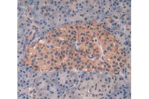 IHC-P analysis of pancreas tissue, with DAB staining.