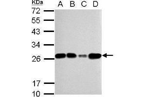 WB Image Sample (30 ug of whole cell lysate) A: 293T B: A431 C: HeLa D: HepG2 12% SDS PAGE antibody diluted at 1:5000 (TFAM 抗体)