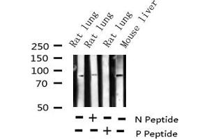 Western blot analysis of Phospho-Cortactin (Tyr421) expression in various lysates (Cortactin 抗体  (pTyr421))