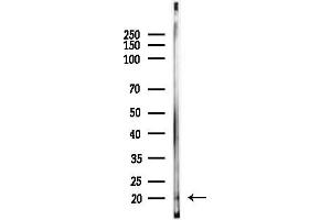 anti-HCG beta antibody