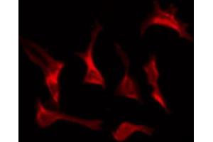 ABIN6274385 staining HepG2 by IF/ICC. (DOK7 抗体  (C-Term))