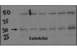Endothelial cell lysate transferred to membrane was incubated with DSCR1 antibody at a 1:500 dilution. (RCAN1 抗体  (AA 222-252))