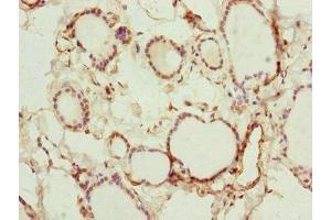 Immunohistochemistry of paraffin-embedded human thyroid tissue using ABIN7151127 at dilution of 1:100 (RNF114 抗体  (AA 1-228))