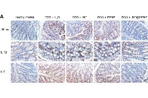 (A) Immunohistochemical staining for TNF-α, IL-1β, and IL-6 in colon tissues of different groups. (IL-6 抗体  (AA 30-212))