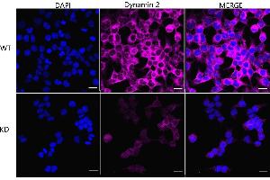 Immunocytochemical staining of HeLa cells using Dynamin 2 antibody (ABIN7798399), 1:1,000), Top panel: wild-type (WT), Bottom panal: Dynamin 2 shRNA knockdown (KD).