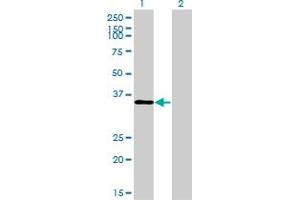 Western Blot analysis of TSTA3 expression in transfected 293T cell line by TSTA3 monoclonal antibody (M01), clone 2B9. (TSTA3 抗体  (AA 222-321))