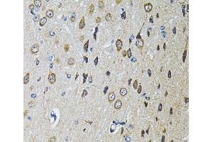 Immunohistochemistry of paraffin-embedded Rat brain using PTPRE Polyclonal Antibody at dilution of 1:100 (40x lens). (PTPRE 抗体)