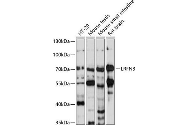 LRFN3 Antikörper  (AA 380-530)