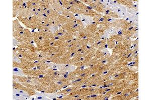 Immunohistochemistry analysis of paraffin-embedded mouse heart using TNNT2 Polyclonal Antibody at dilution of 1:200. (Cardiac Troponin T2 抗体)
