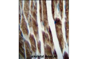 ILKAP Antibody immunohistochemistry analysis in formalin fixed and paraffin embedded human skeletal muscle followed by peroxidase conjugation of the secondary antibody and DAB staining.