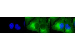 Immunocytochemistry/Immunofluorescence analysis using Mouse Anti-Hsp90 complex Monoclonal Antibody, Clone 8D3 (ABIN361731 and ABIN361732).