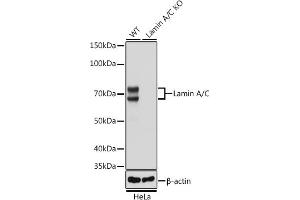 Western blot analysis of extracts from wild type (WT) and Lamin A/C knockout (KO) HeLa cells, using Lamin A/C antibody (ABIN7268177) at 1:50000 dilution. (Lamin A/C 抗体)