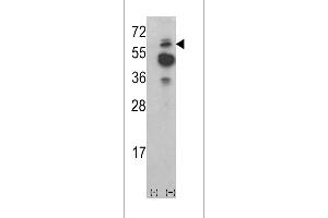 Western Blotting (WB) image for anti-tyrosine Kinase, Non-Receptor, 2 (TNK2) (AA 10-39), (N-Term) antibody (ABIN392082)