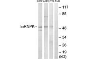 Western blot analysis of extracts from K562/A549/HT-29 cells, using hnRNP K (Ab-284) Antibody. (HNRNPK 抗体  (AA 250-299))