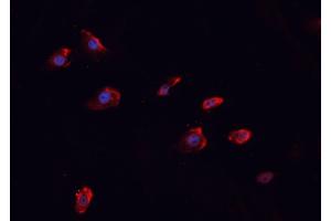 ABIN6266458 staining MCF-7 cells by IF/ICC. (MUC1 抗体  (pTyr1229))