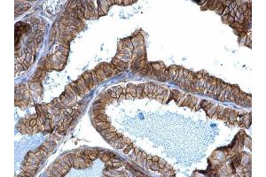 IHC-P Image alpha Adducin antibody detects alpha Adducin protein at membrane on mouse prostate by immunohistochemical analysis. (alpha Adducin 抗体)