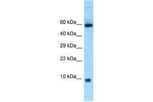 WB Suggested Anti-S100A7A Antibody Titration: 1. (S100A7A 抗体  (Middle Region))